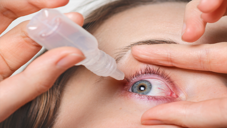 Pink Eye Conjunctivitis