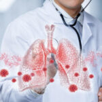 Pneumonia Symptoms