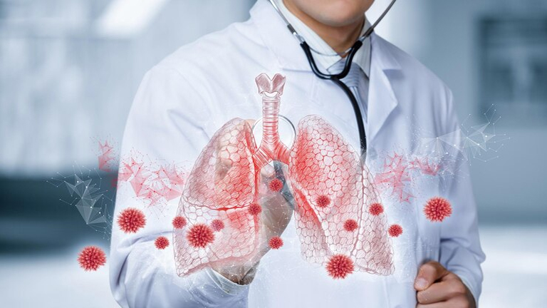 Pneumonia Symptoms