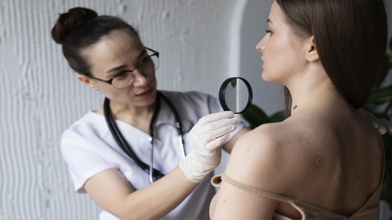 Skin Cancer