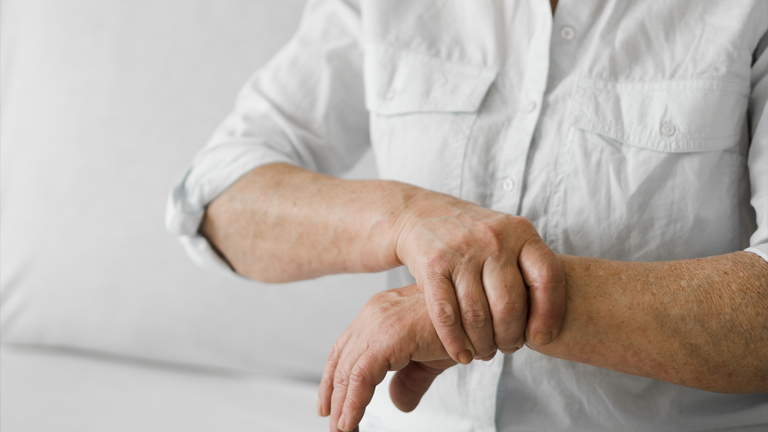 Ganglion Cyst