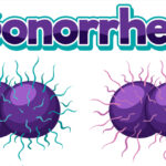 Gonorrhea
