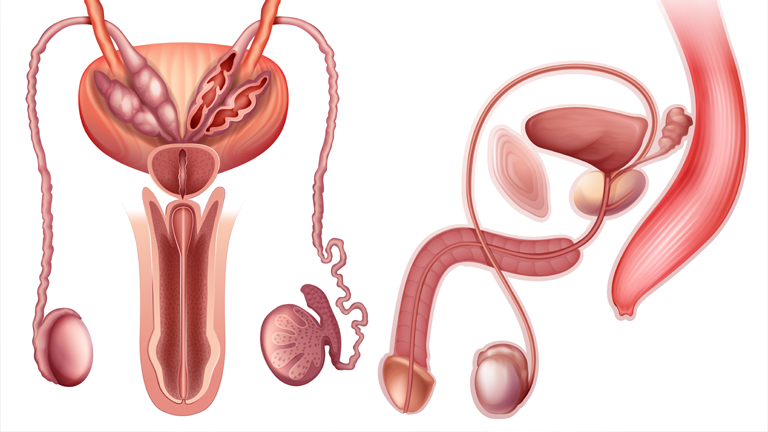 Gonorrhea