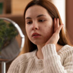 Hormonal Acne