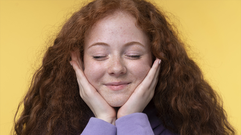 Hormonal Acne