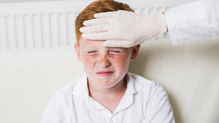 Measles Symptoms