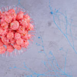 Squamous Cell Carcinoma