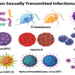 Syphilis