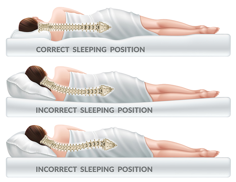Best Sleep Position for Lower Back Pain Relief