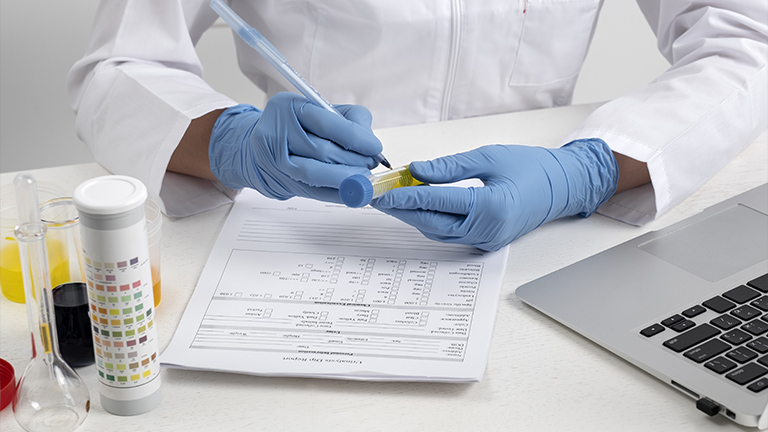 Estrogen Test