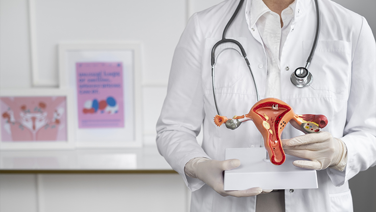 Ovarian Cysts