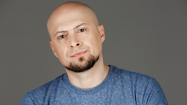 Male Pattern Baldness