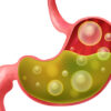 Natural Remedies for Gas and Stomach