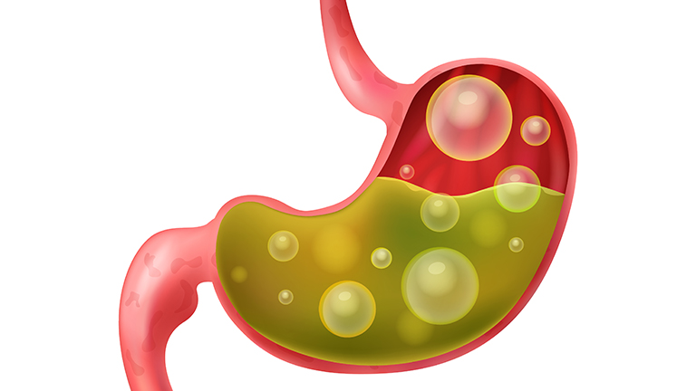 Natural Remedies for Gas and Stomach