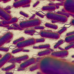 Small Intestinal Bacterial Overgrowth (SIBO)