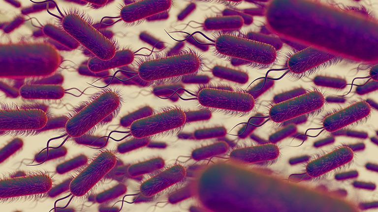 Small Intestinal Bacterial Overgrowth (SIBO)