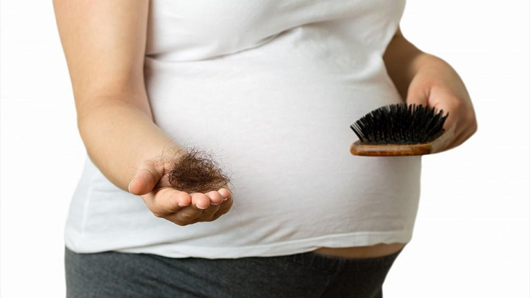 Stop Hair Thinning After Pregnancy