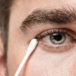 natural remedies for dry eyes