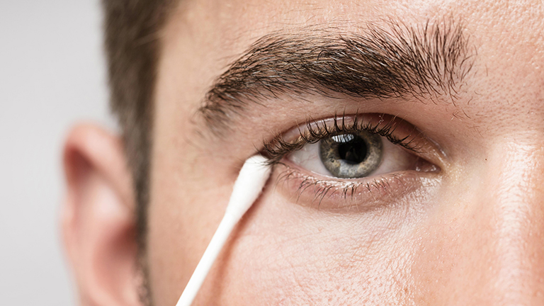 natural remedies for dry eyes