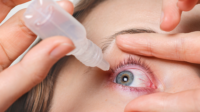 natural remedies for dry eyes