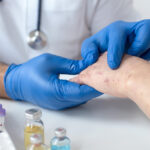 measles outbreak causes and prevention
