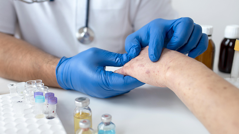 measles outbreak causes and prevention