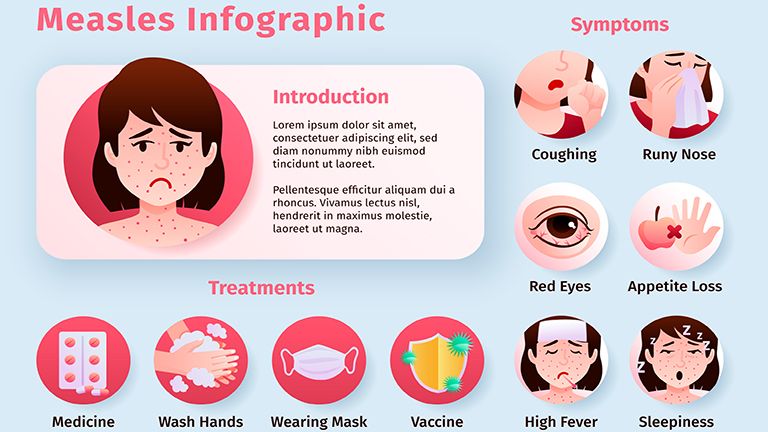 measles outbreak causes and prevention