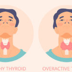 Thyroid disease symptoms